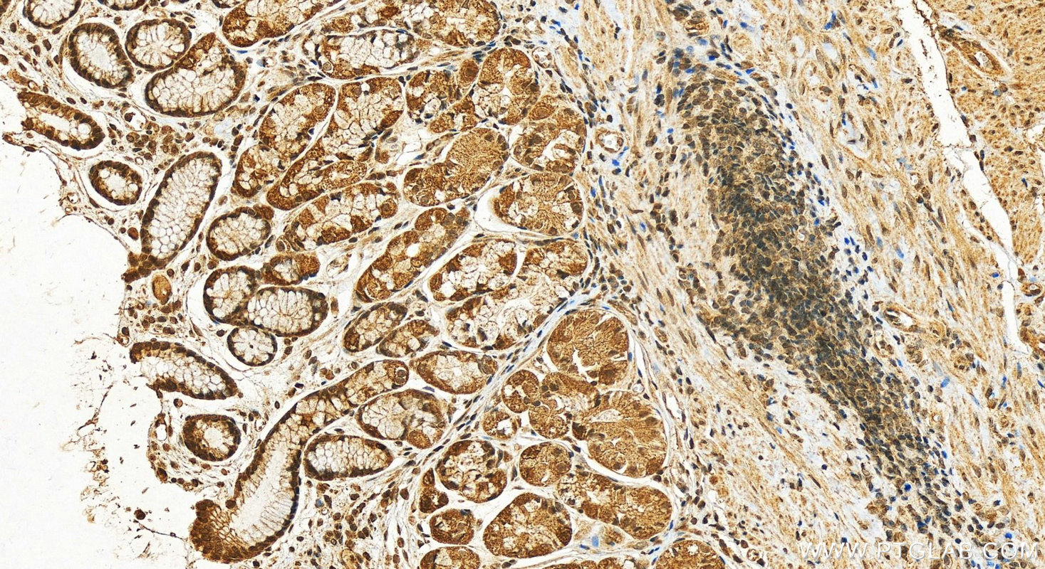 IHC staining of human stomach using 18181-1-AP