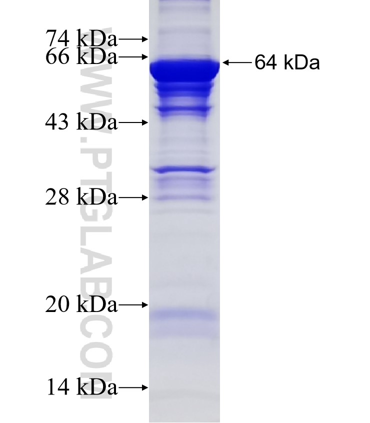 NOP56 fusion protein Ag12882 SDS-PAGE