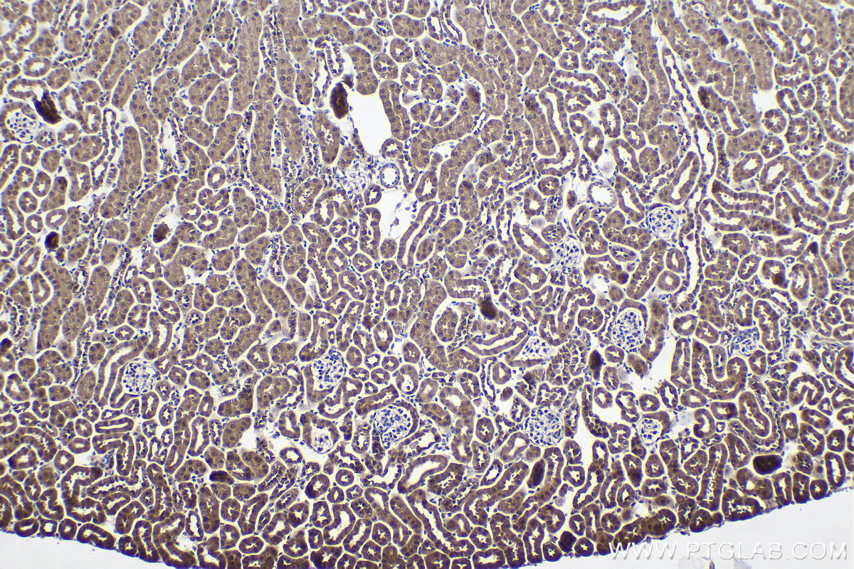 IHC staining of mouse kidney using 14409-1-AP