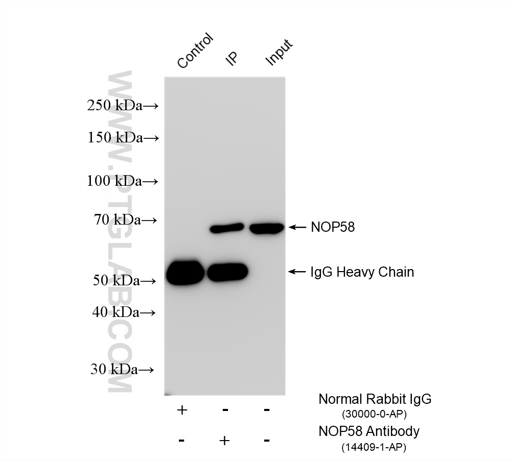 IP result of anti-NOP58 (IP:14409-1-AP, 4ug; Detection:14409-1-AP 1:8000) with HeLa cells lysate 1400 ug. IP experiment of HeLa using 14409-1-AP