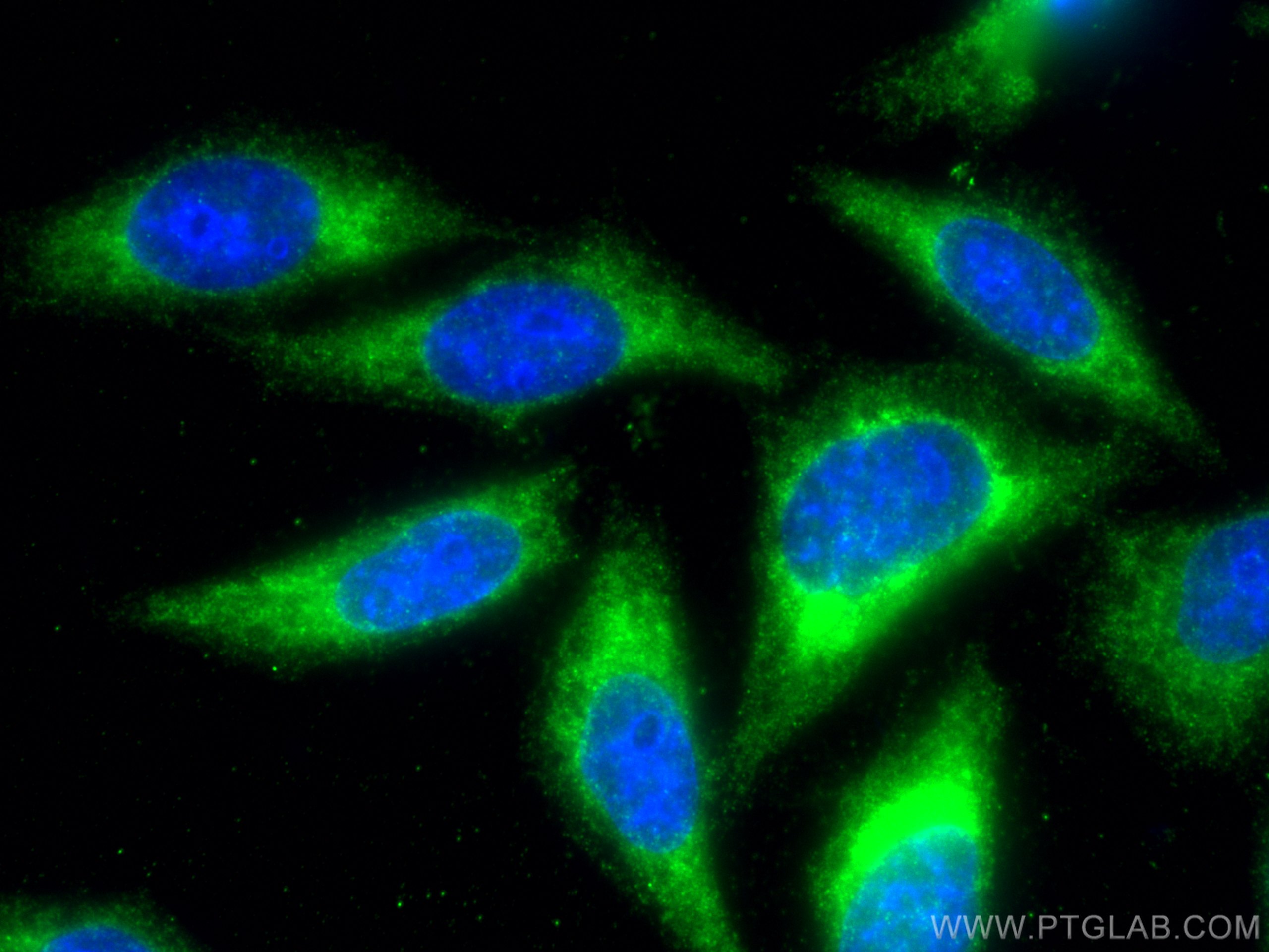 IF Staining of HepG2 using 18985-1-AP