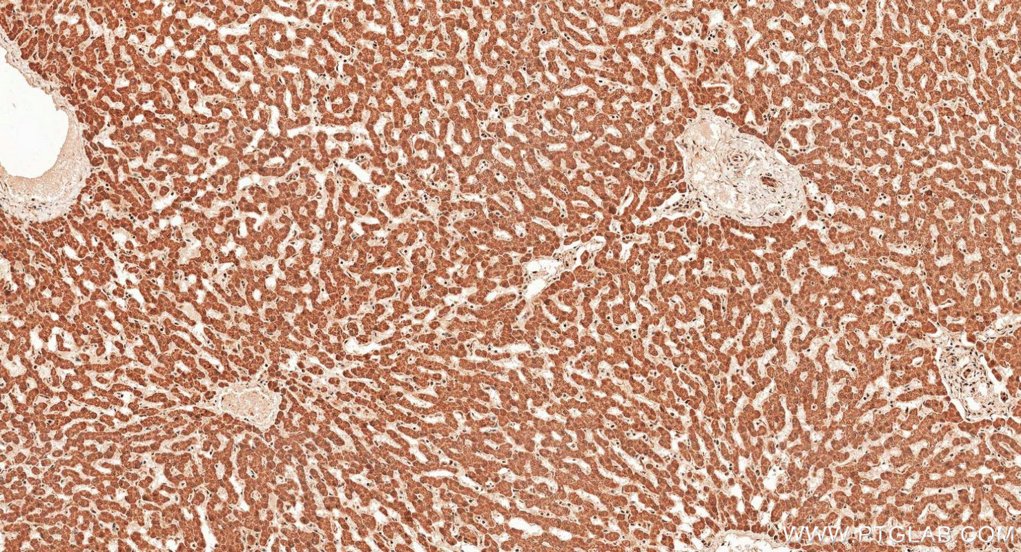 IHC staining of human liver using 18985-1-AP