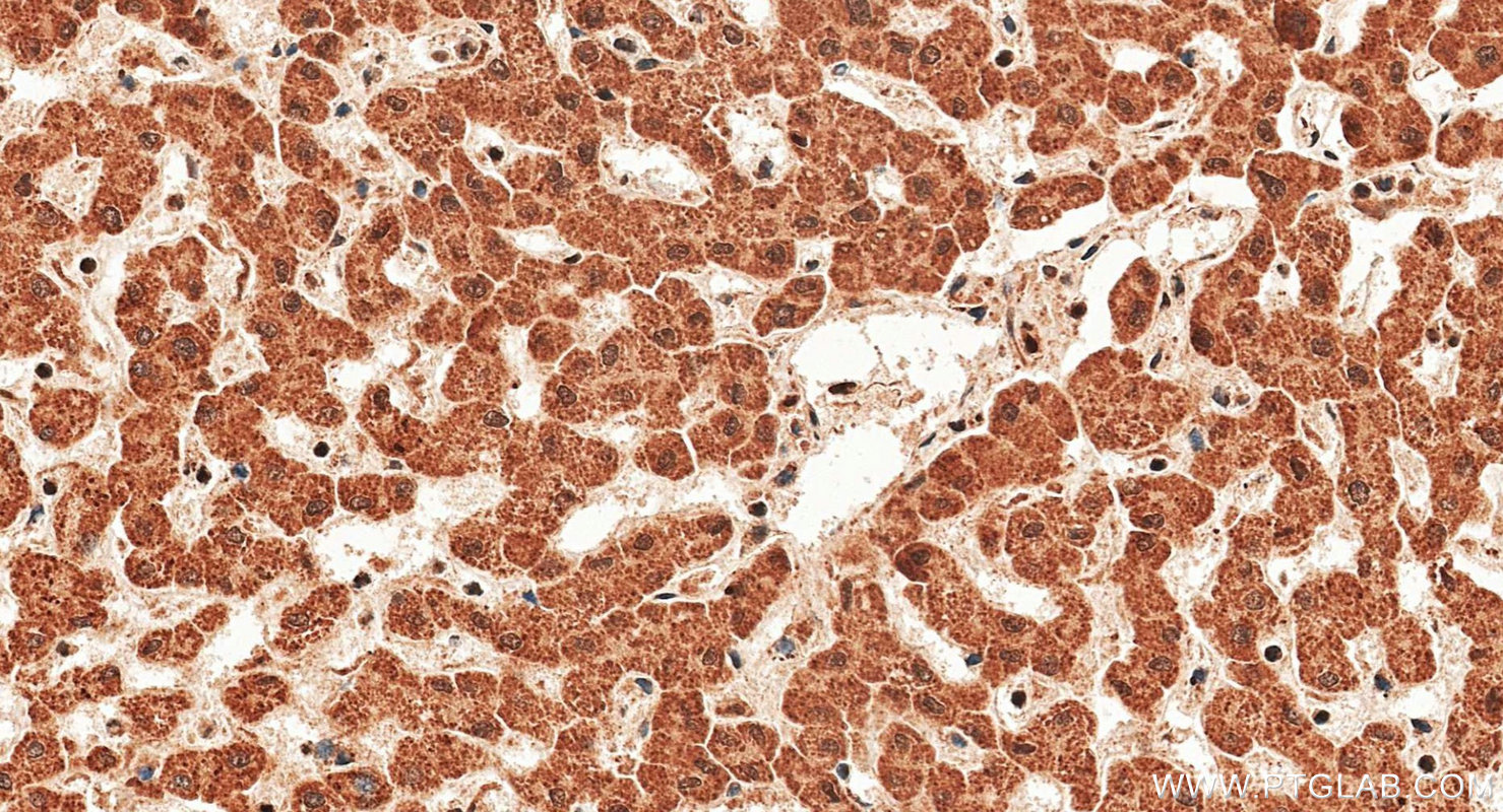 IHC staining of human liver using 18985-1-AP