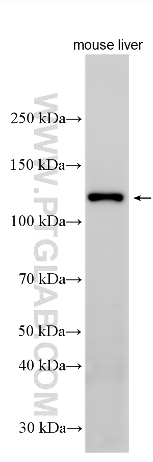 WB analysis using 18985-1-AP