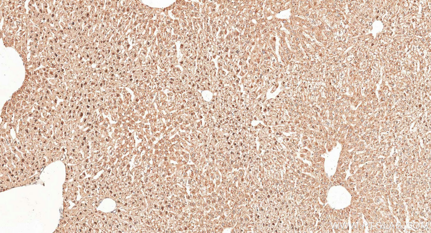 IHC staining of mouse liver using 22226-1-AP IHC staining of mouse liver using 22226-1-AP