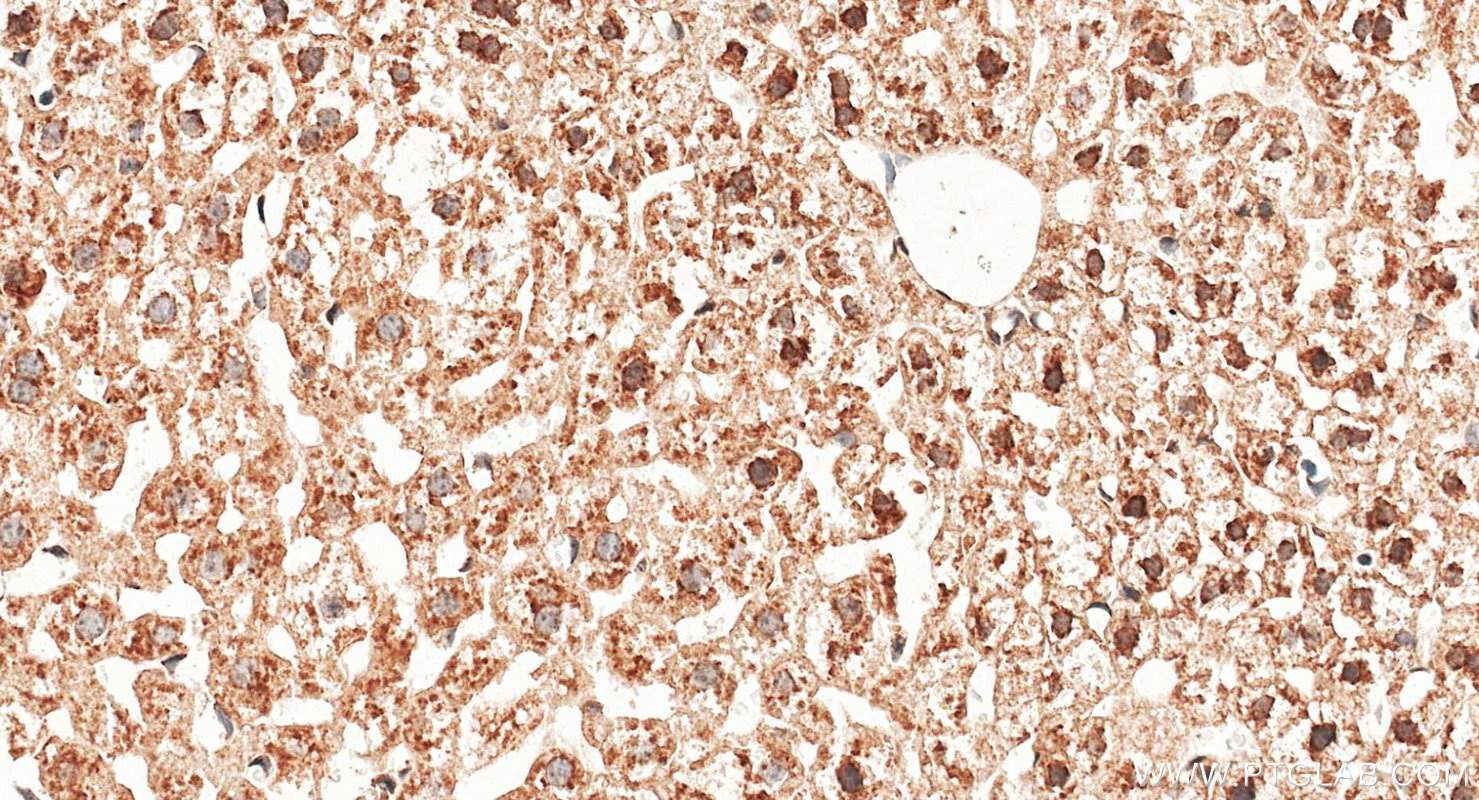 IHC staining of mouse liver using 22226-1-AP IHC staining of mouse liver using 22226-1-AP