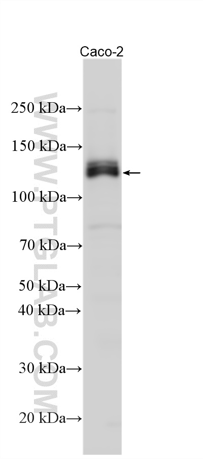 Various lysates were subjected to SDS PAGE followed by western blot with 22226-1-AP (iNOS antibody) at dilution of 1:1000 incubated at room temperature for 1.5 hours. WB analysis using 22226-1-AP