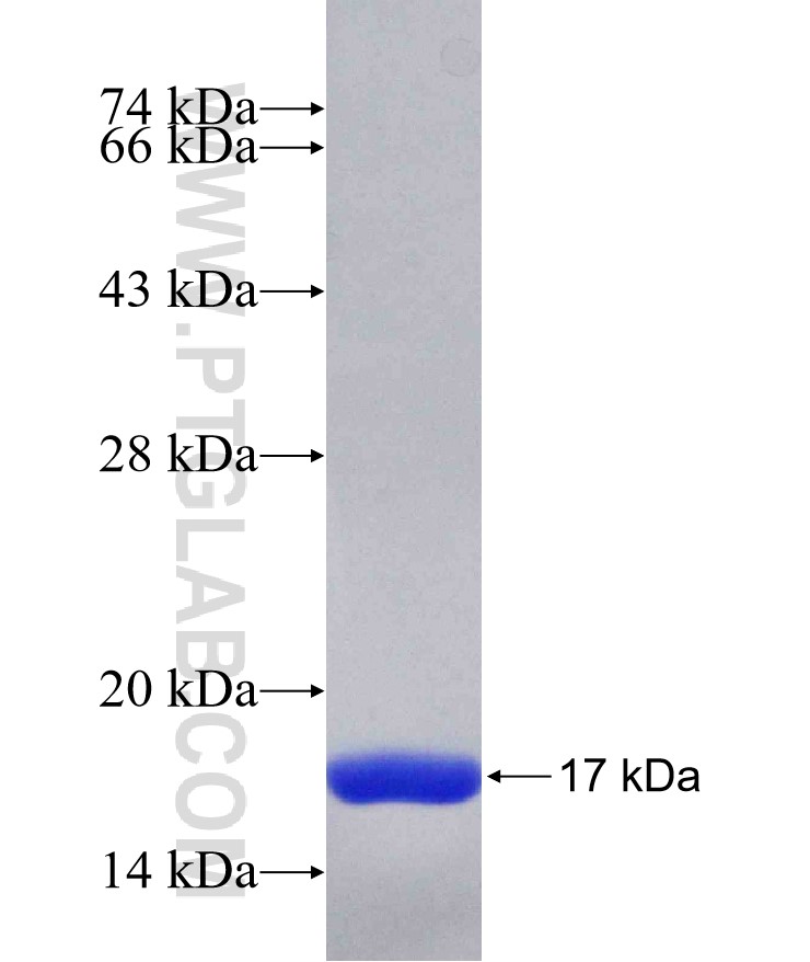 NOS2 fusion protein Ag26241 SDS-PAGE