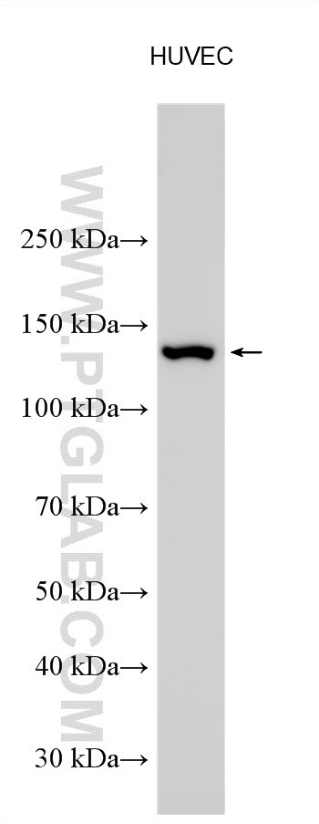 Various lysates were subjected to SDS PAGE followed by western blot with 27120-1-AP (eNOS antibody) at dilution of 1:10000 incubated at room temperature for 1.5 hours. WB analysis using 27120-1-AP