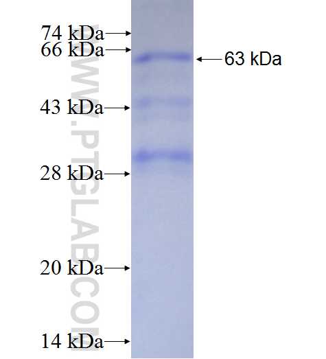 NOSIP fusion protein Ag1562 SDS-PAGE NOSIP fusion protein Ag1562 SDS-PAGE