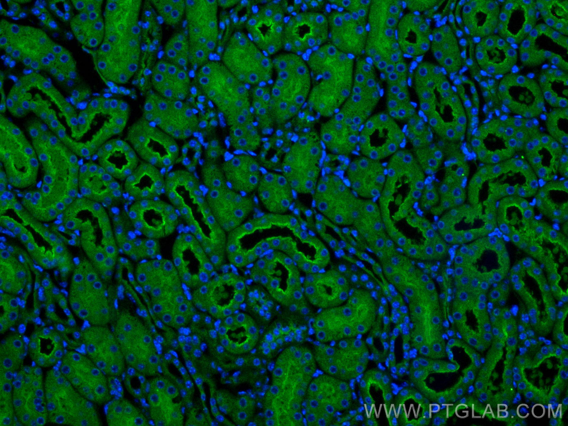 IF Staining of mouse kidney using 20116-1-AP