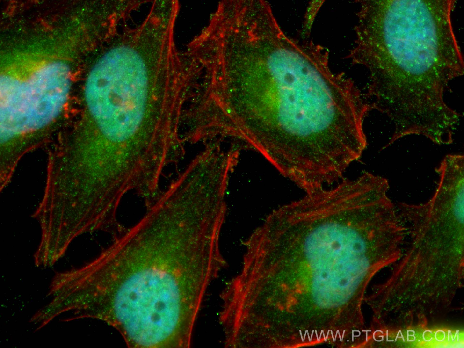 IF Staining of HeLa using 20687-1-AP