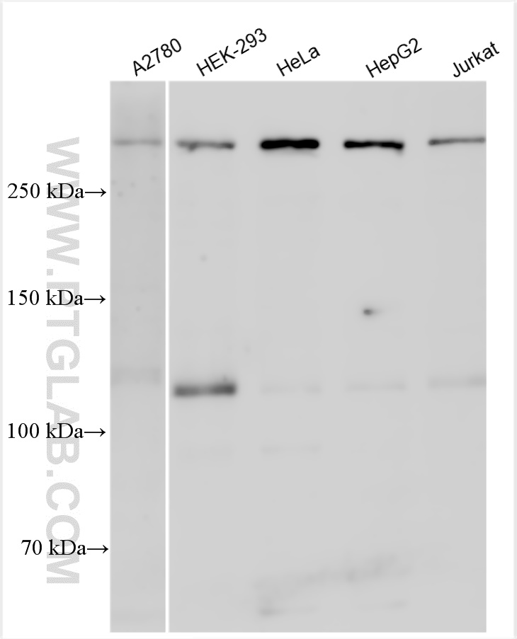 WB analysis using 20687-1-AP