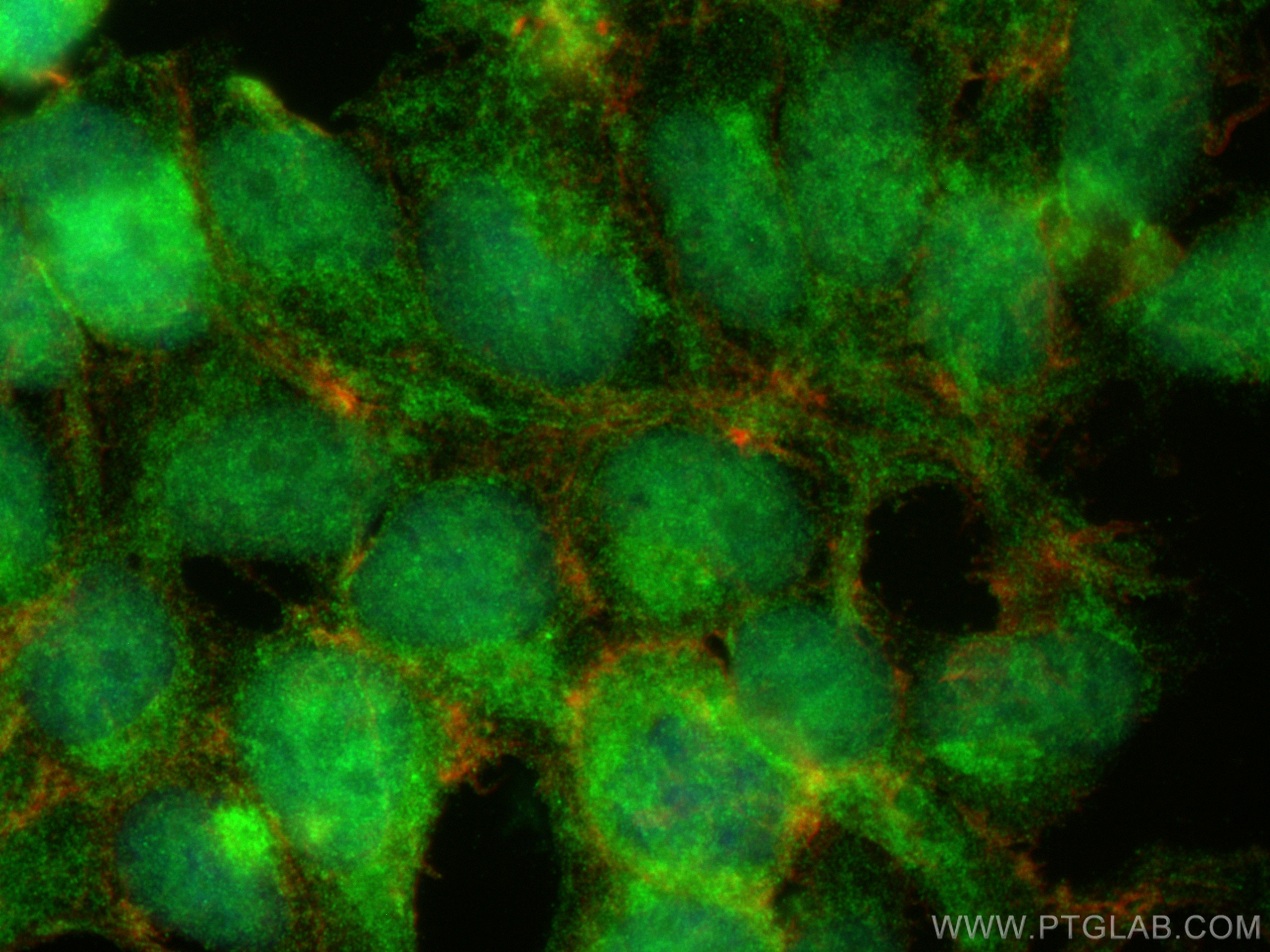 IF Staining of HEK-293 using 28580-1-AP