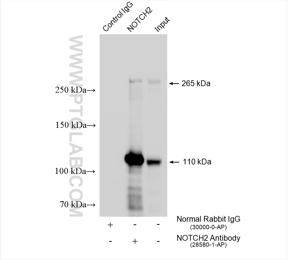 IP experiment of U-87 MG using 28580-1-AP