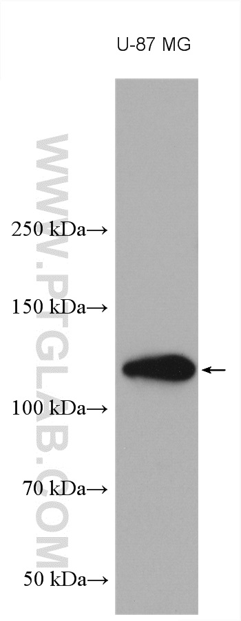 WB analysis using 28580-1-AP