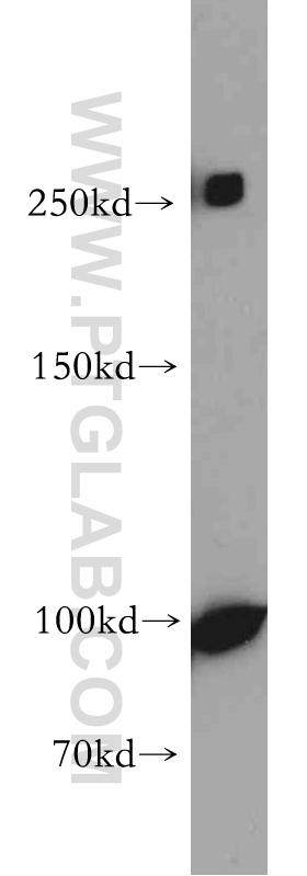 NOTCH3 Polyclonal antibody