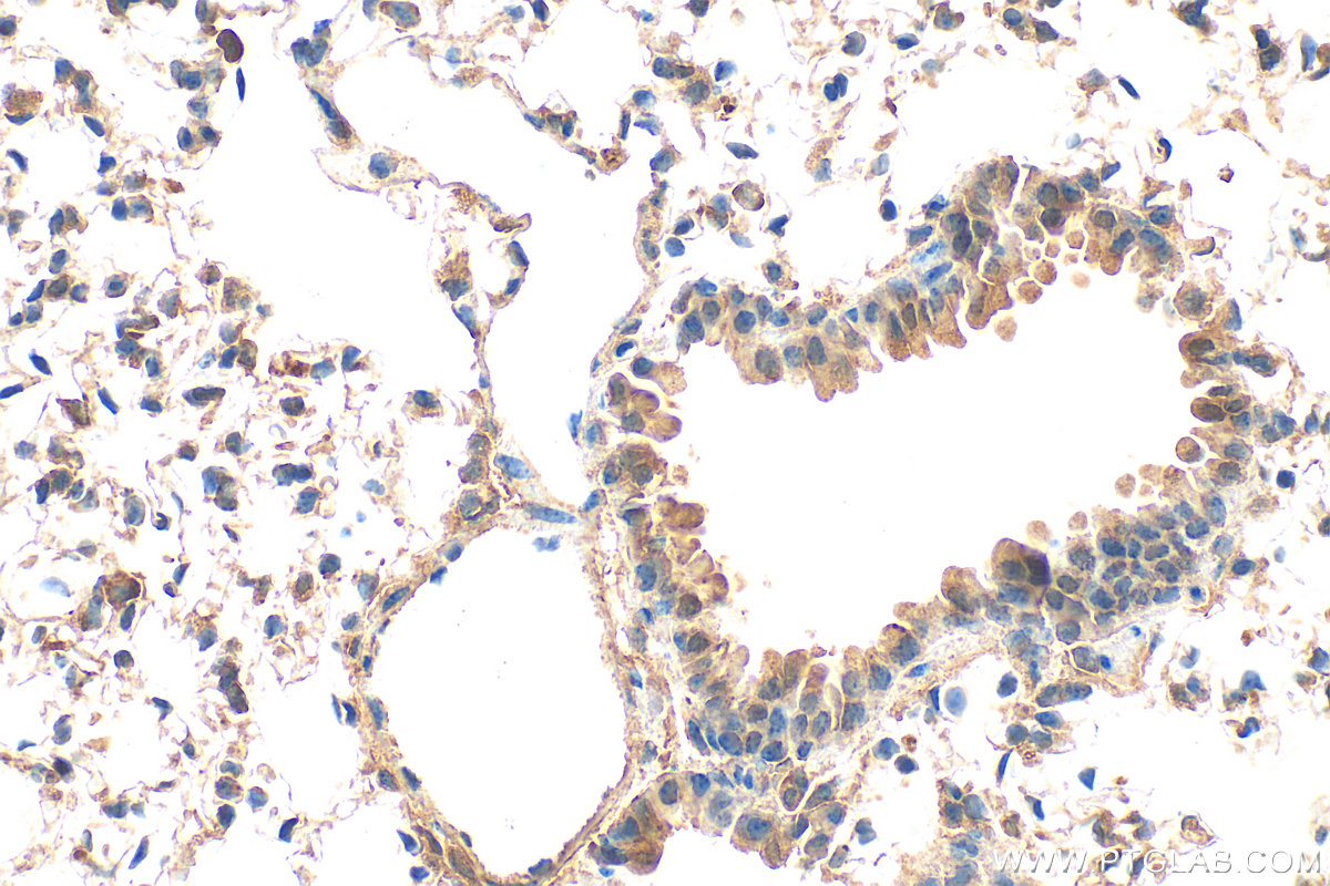 IHC staining of mouse lung using 33280-1-AP