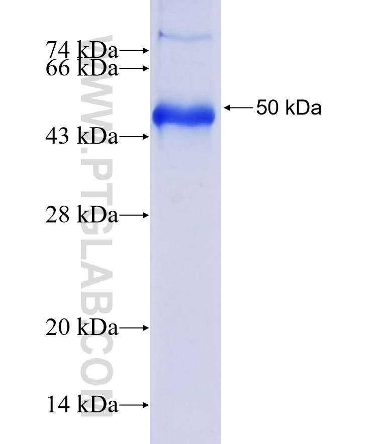 NOTCH4 fusion protein Ag36738 SDS-PAGE NOTCH4 fusion protein Ag36738 SDS-PAGE
