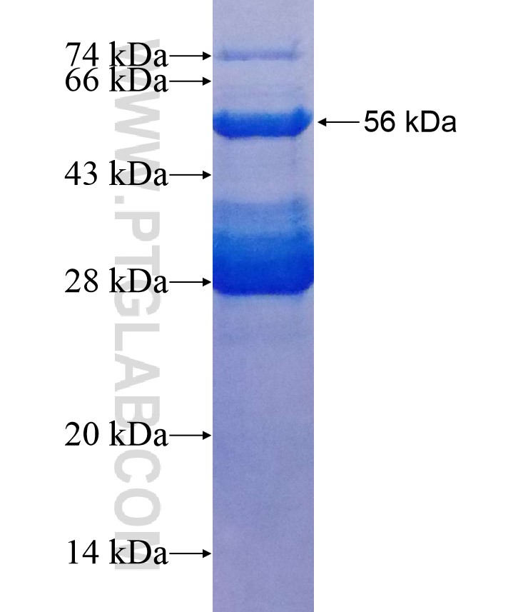 NOTCH4 fusion protein Ag18066 SDS-PAGE NOTCH4 fusion protein Ag18066 SDS-PAGE