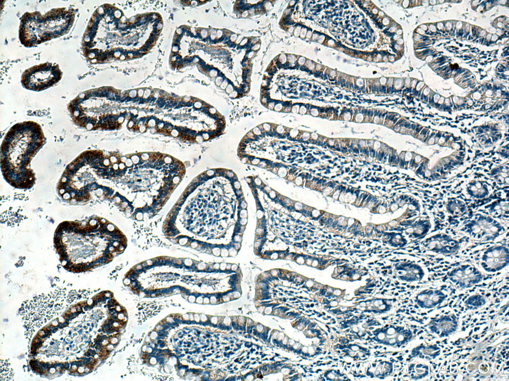 IHC staining of human small intestine using 66956-1-Ig