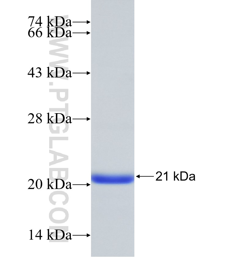 NOTUM fusion protein Ag31010 SDS-PAGE