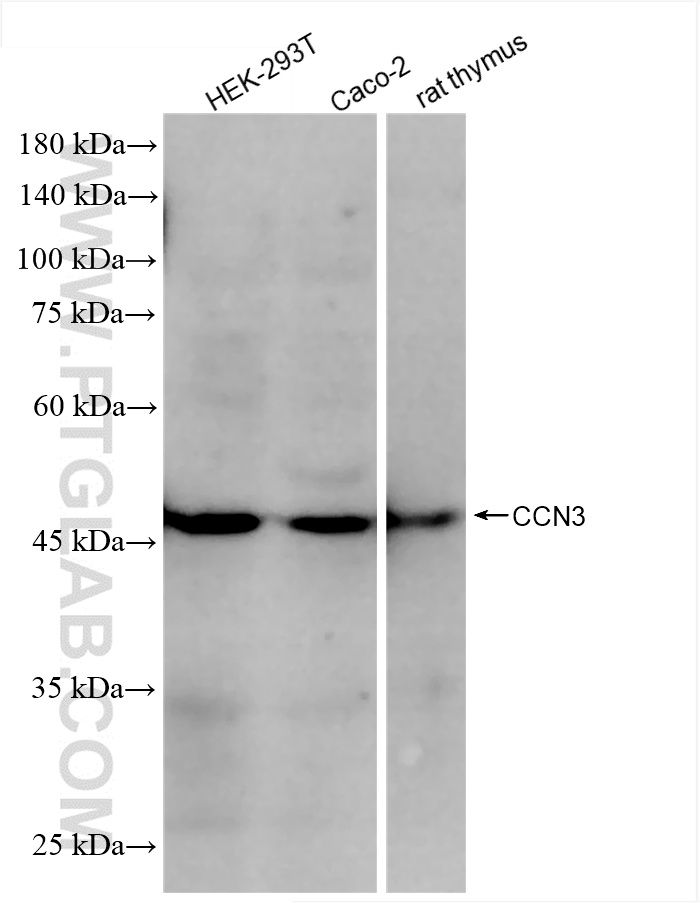 WB analysis using 85731-1-RR