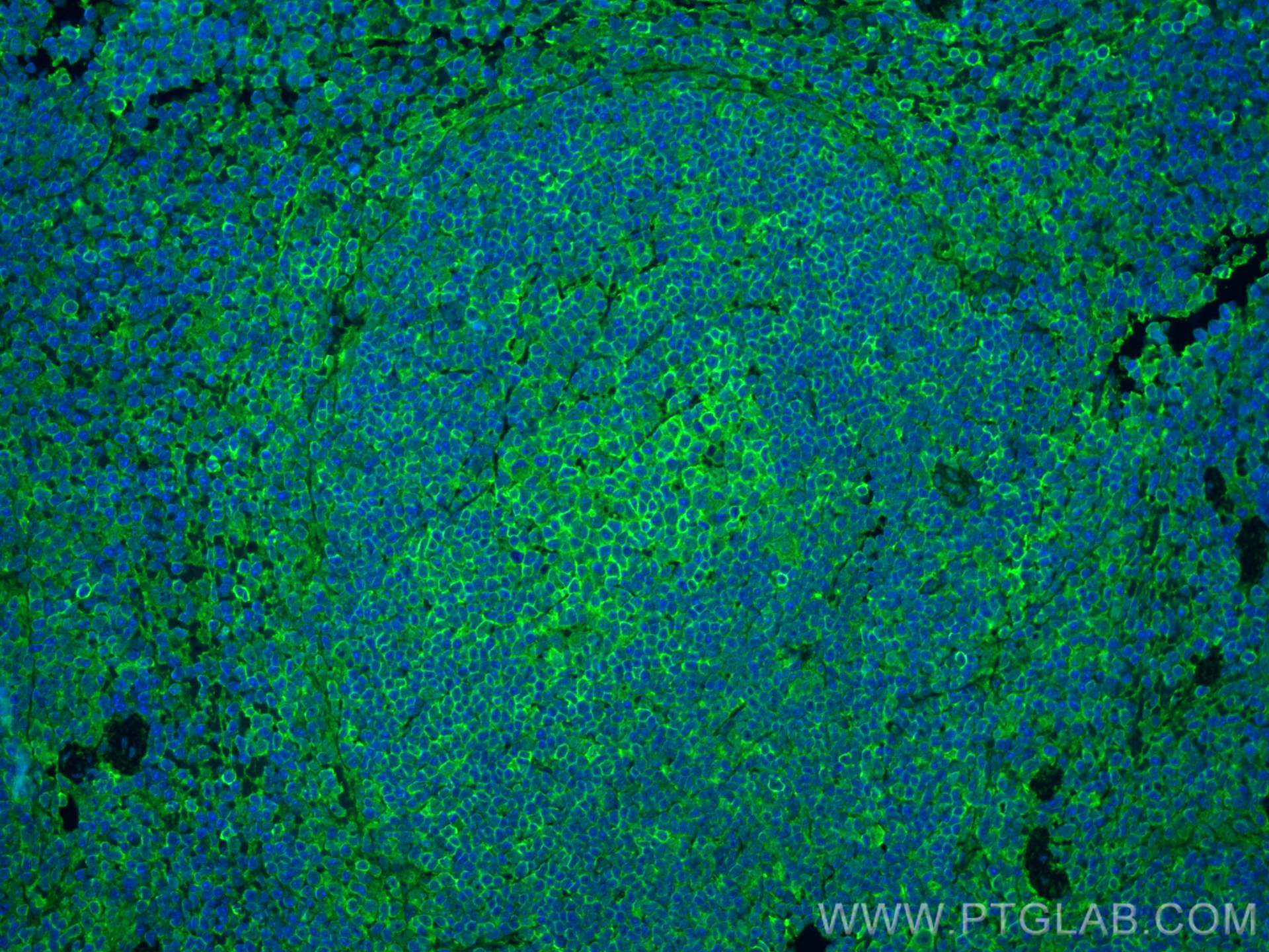IF Staining of mouse spleen using 82872-1-RR (same clone as 82872-1-PBS)