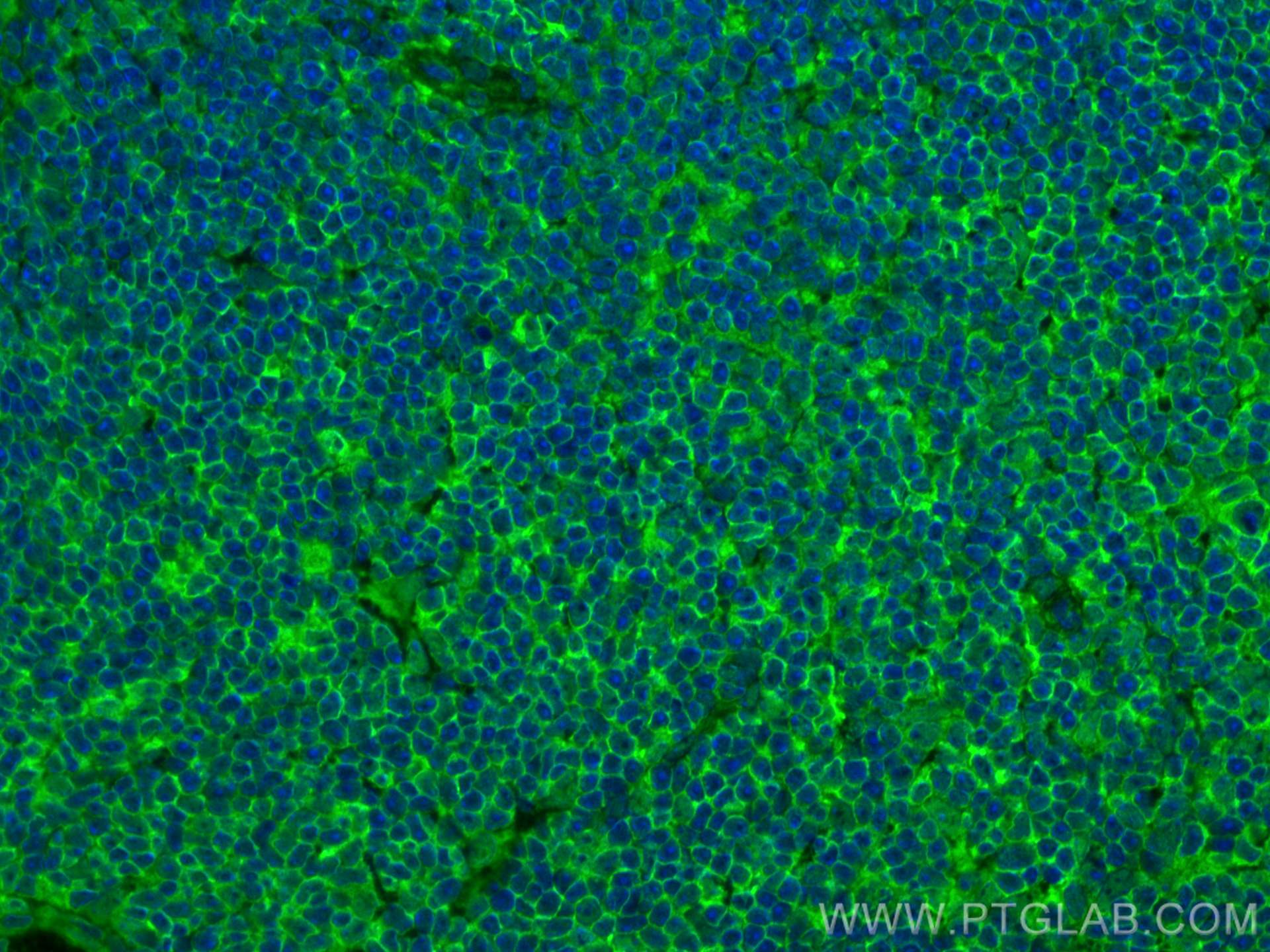 IF Staining of mouse spleen using 82872-1-RR (same clone as 82872-1-PBS)