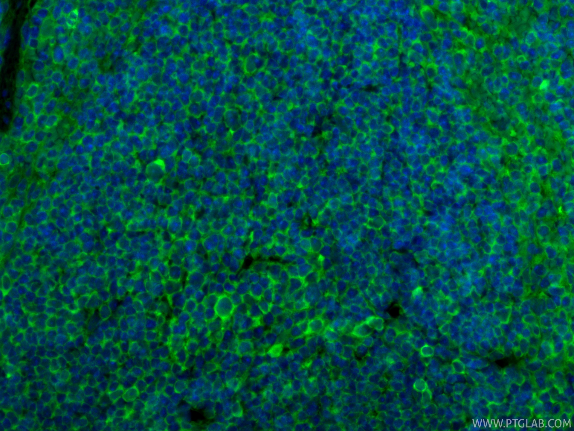 Immunofluorescent analysis of (4% PFA) fixed paraffin-embedded mouse spleen tissue using CoraLite® Plus 488 NOX2 antibody (CL488-82872, Clone: 1B17 ) at dilution of 1:200. Heat mediated antigen retrieval with Tris-EDTA buffer (pH 9.0). IF Staining of mouse spleen using CL488-82872