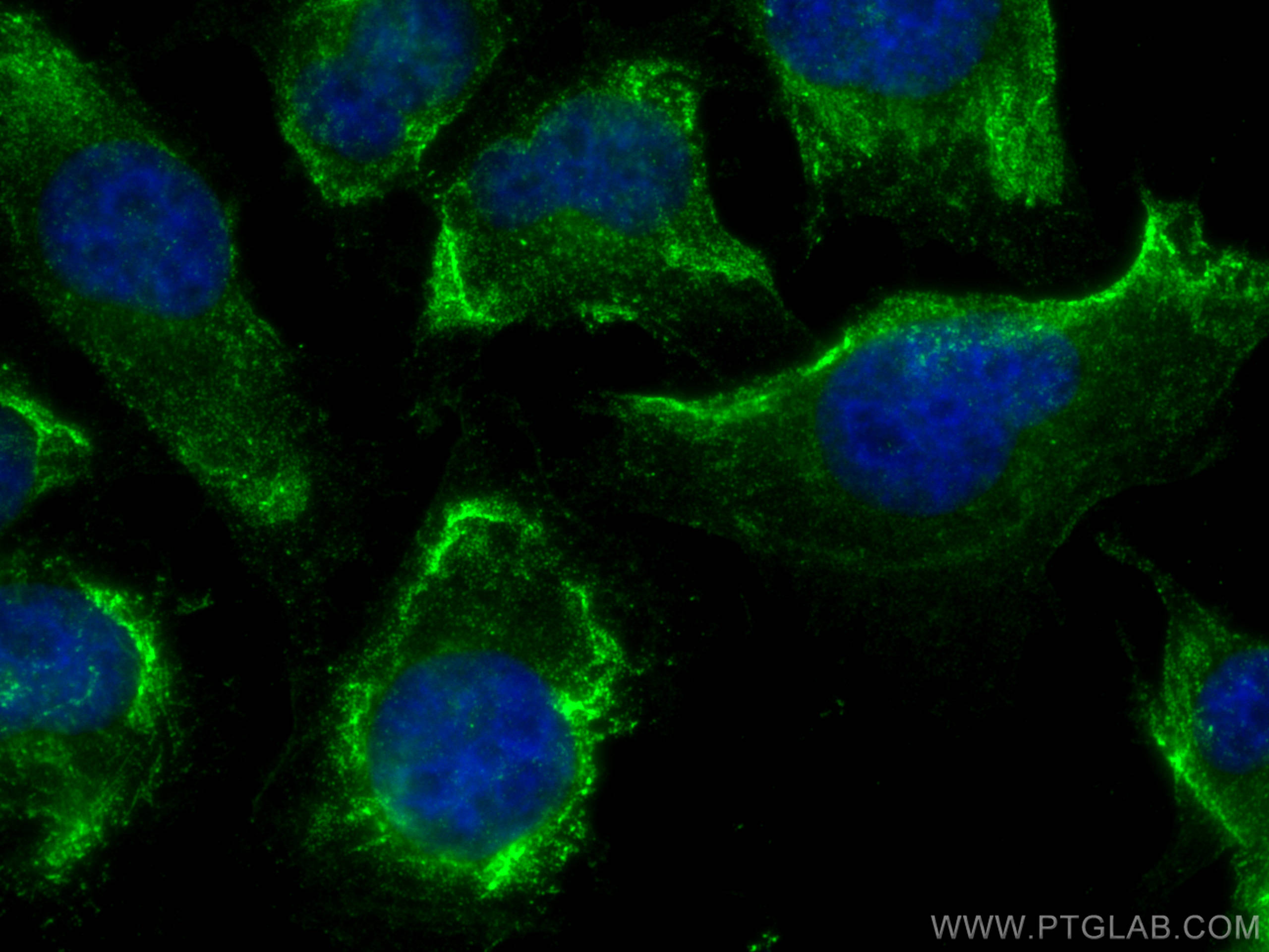 IF Staining of HUVEC using 67681-1-Ig (same clone as 67681-1-PBS)
