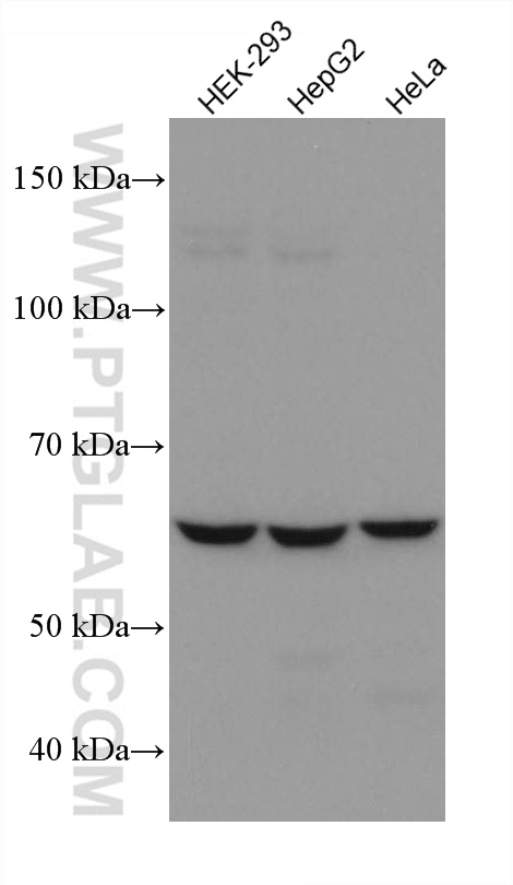 WB analysis using 67681-1-Ig