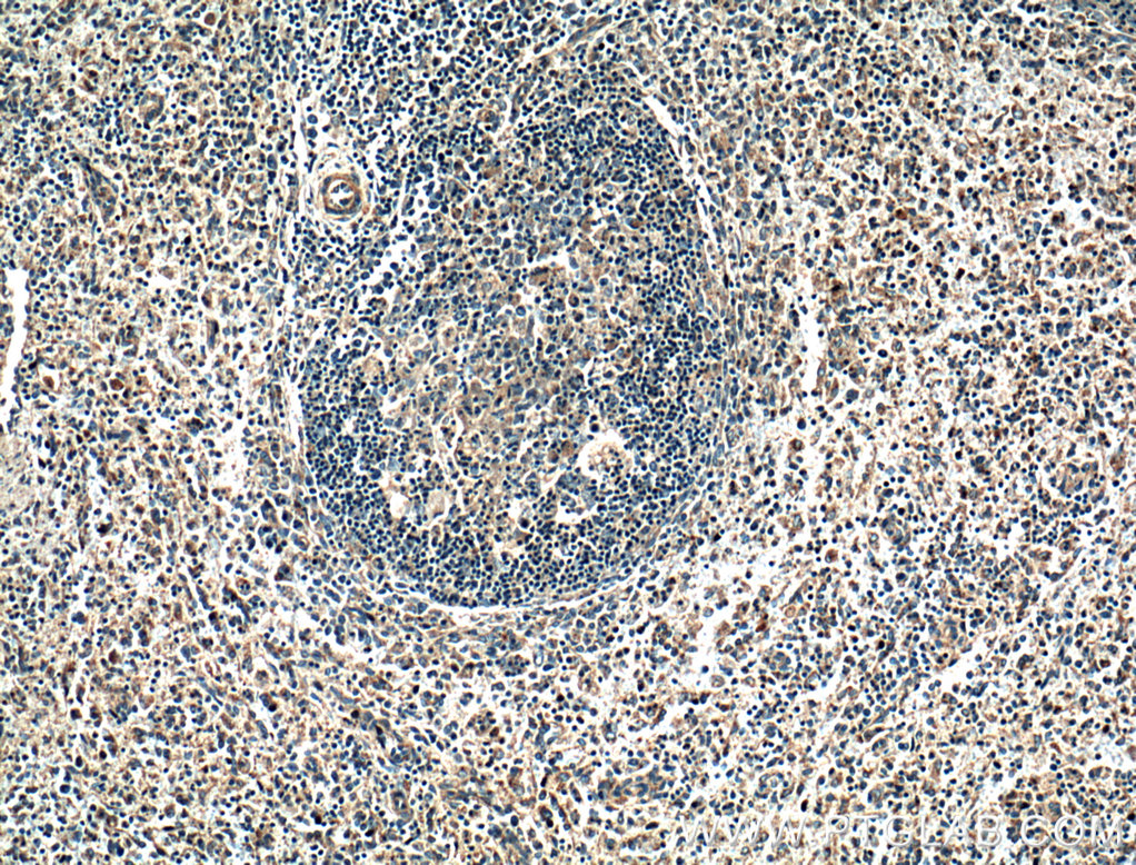 IHC staining of human spleen using 25350-1-AP