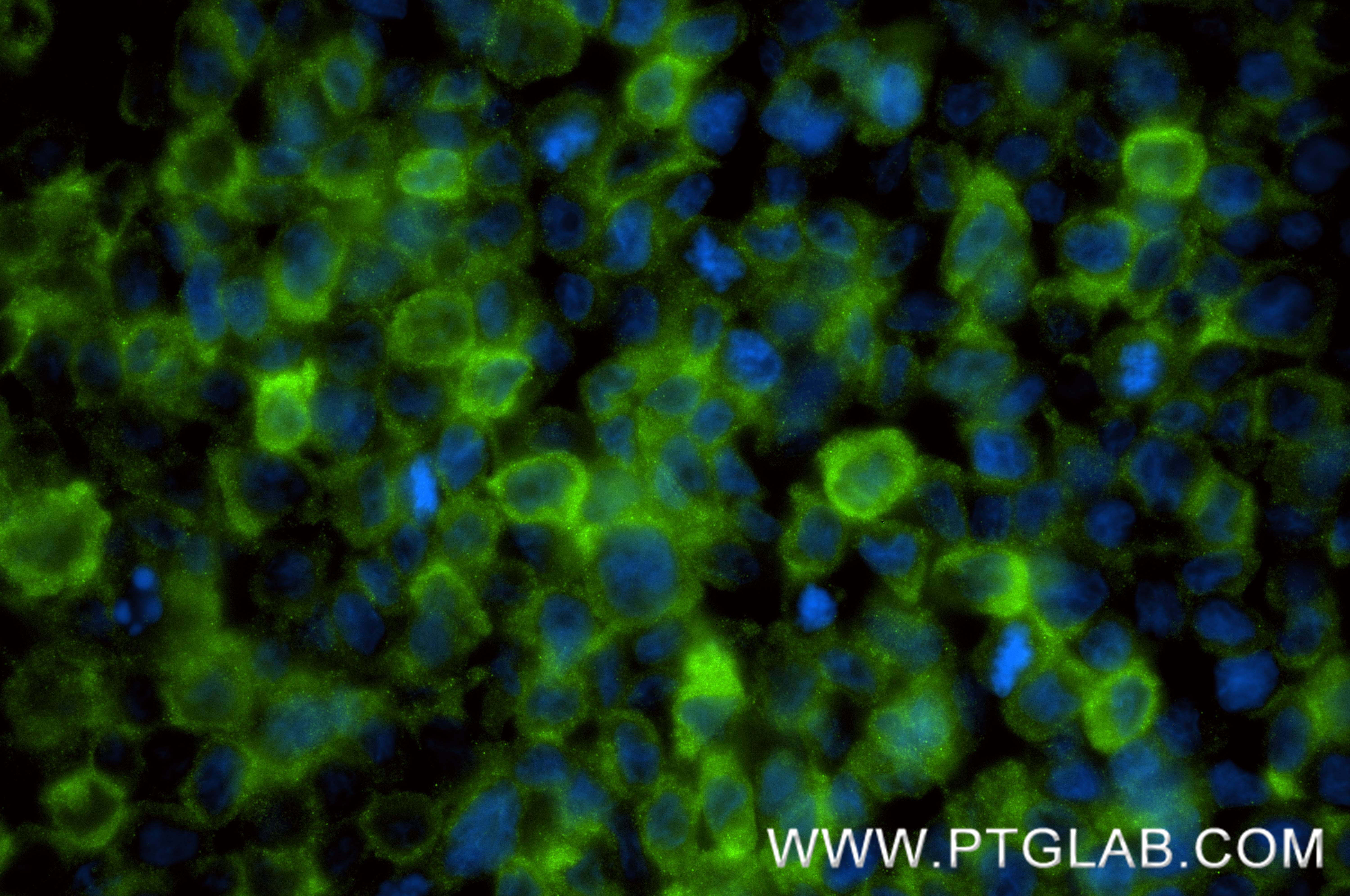 IF Staining of THP-1 using 88418-1-RR IF Staining of THP-1 using 88418-1-RR