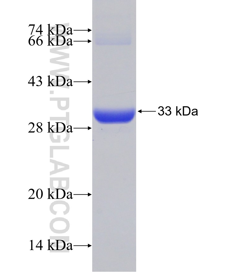 NP fusion protein Ag12485 SDS-PAGE NP fusion protein Ag12485 SDS-PAGE