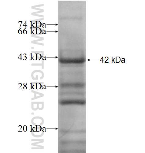 NPAS2 fusion protein Ag10048 SDS-PAGE NPAS2 fusion protein Ag10048 SDS-PAGE
