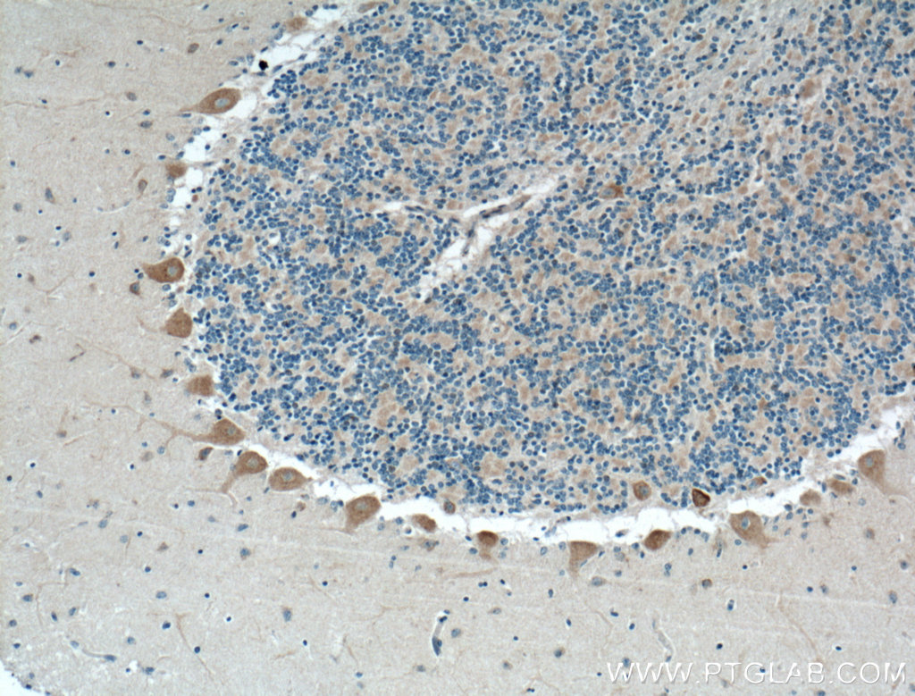 IHC staining of human cerebellum using 24625-1-AP