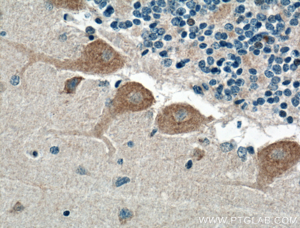 IHC staining of human cerebellum using 24625-1-AP