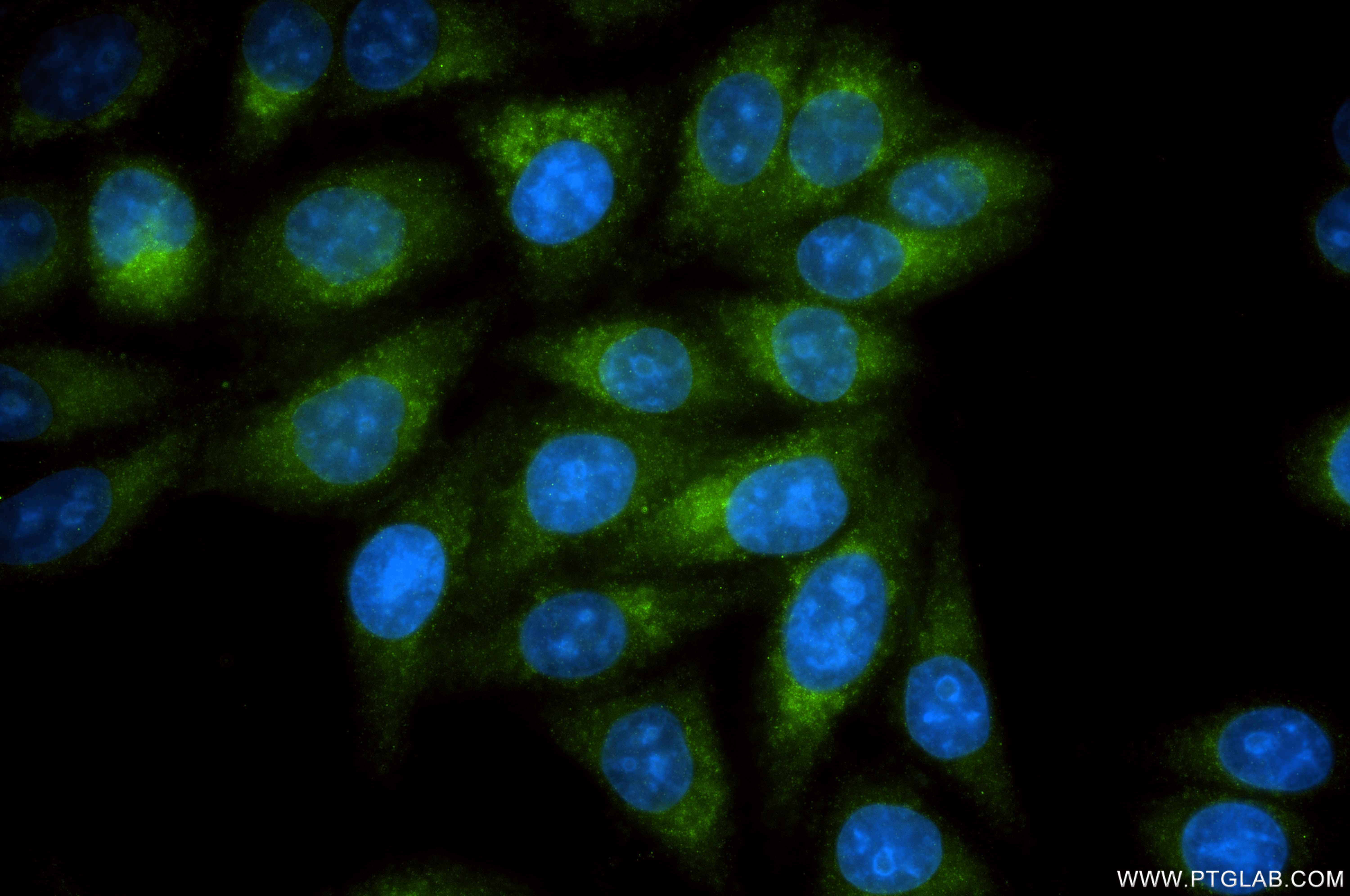 IF Staining of HepG2 using 86233-5-RR IF Staining of HepG2 using 86233-5-RR