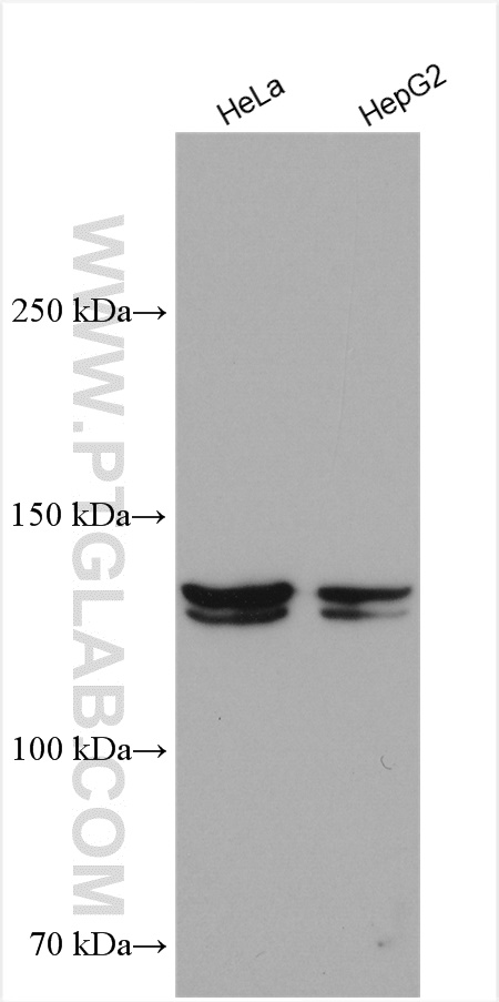 NPC1L1