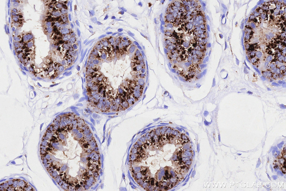 IHC staining of rat epididymis using 86293-1-RR IHC staining of rat epididymis using 86293-1-RR