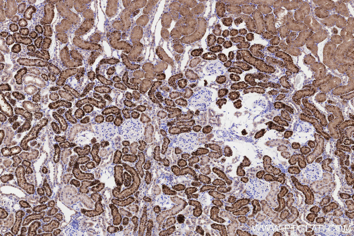 IHC staining of rat kidney using 86293-1-RR IHC staining of rat kidney using 86293-1-RR