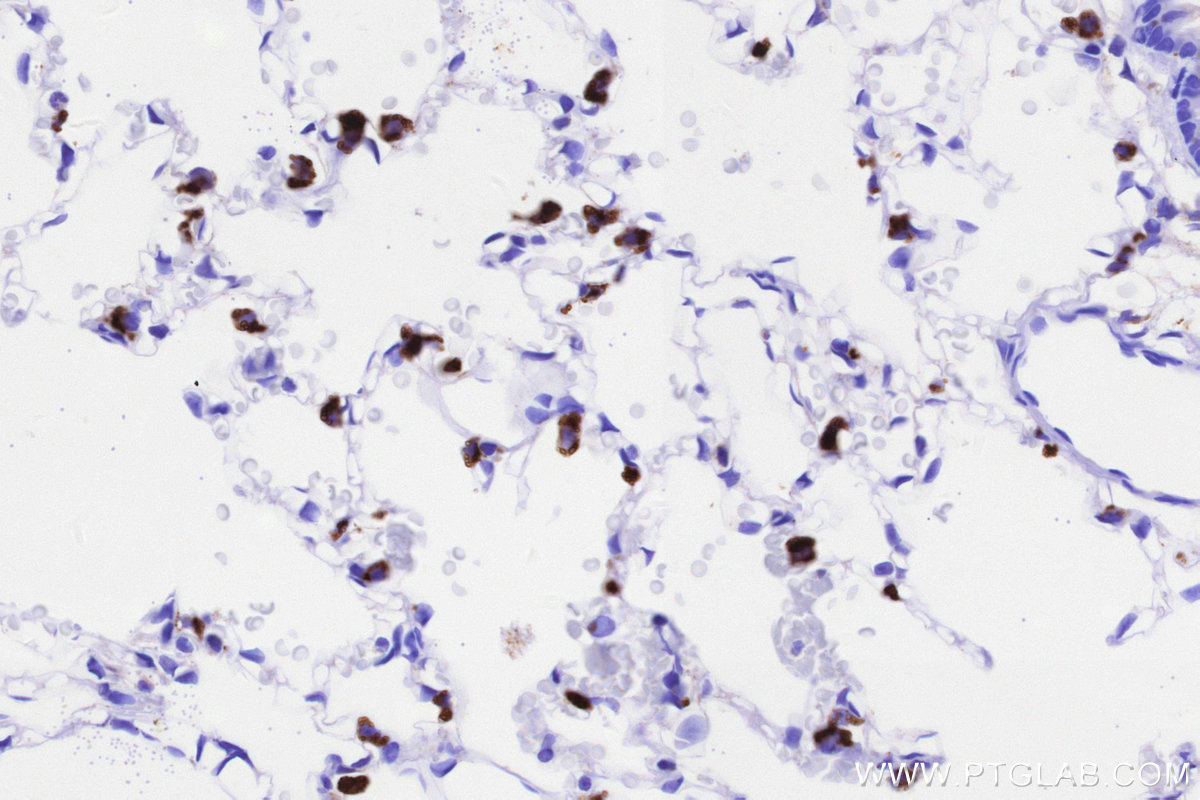IHC staining of rat lung using 86293-1-RR IHC staining of rat lung using 86293-1-RR