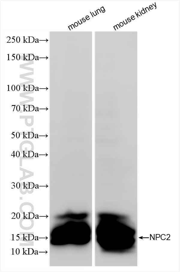 WB analysis using 86293-1-RR