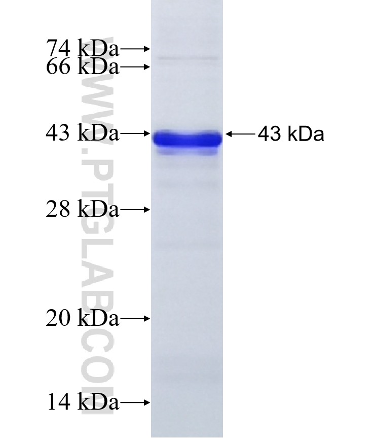 NPDC1 fusion protein Ag7569 SDS-PAGE NPDC1 fusion protein Ag7569 SDS-PAGE