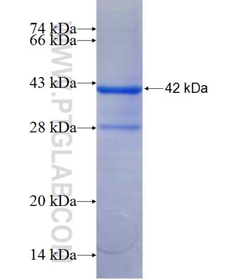 NPEPL1 fusion protein Ag11683 SDS-PAGE NPEPL1 fusion protein Ag11683 SDS-PAGE