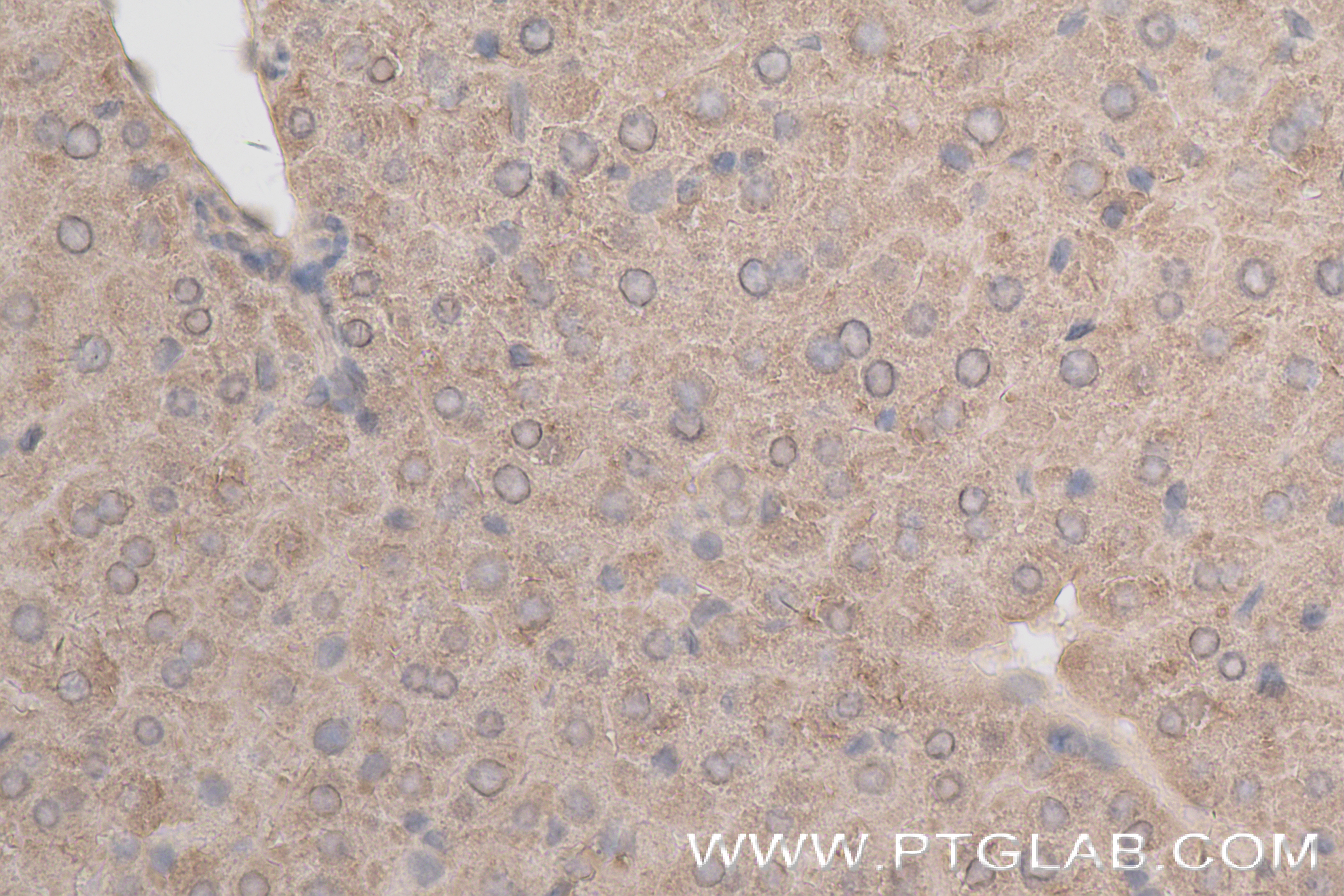 IHC staining of mouse liver using 84230-4-RR (same clone as 84230-4-PBS)