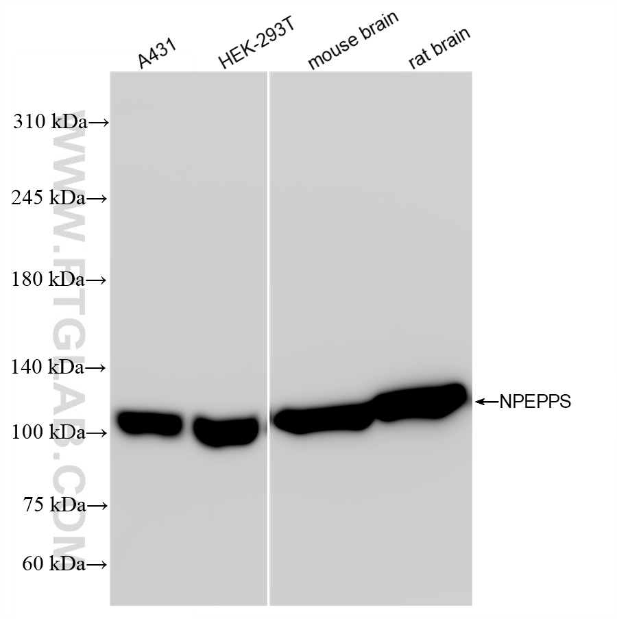 WB analysis using 84230-4-RR (same clone as 84230-4-PBS)
