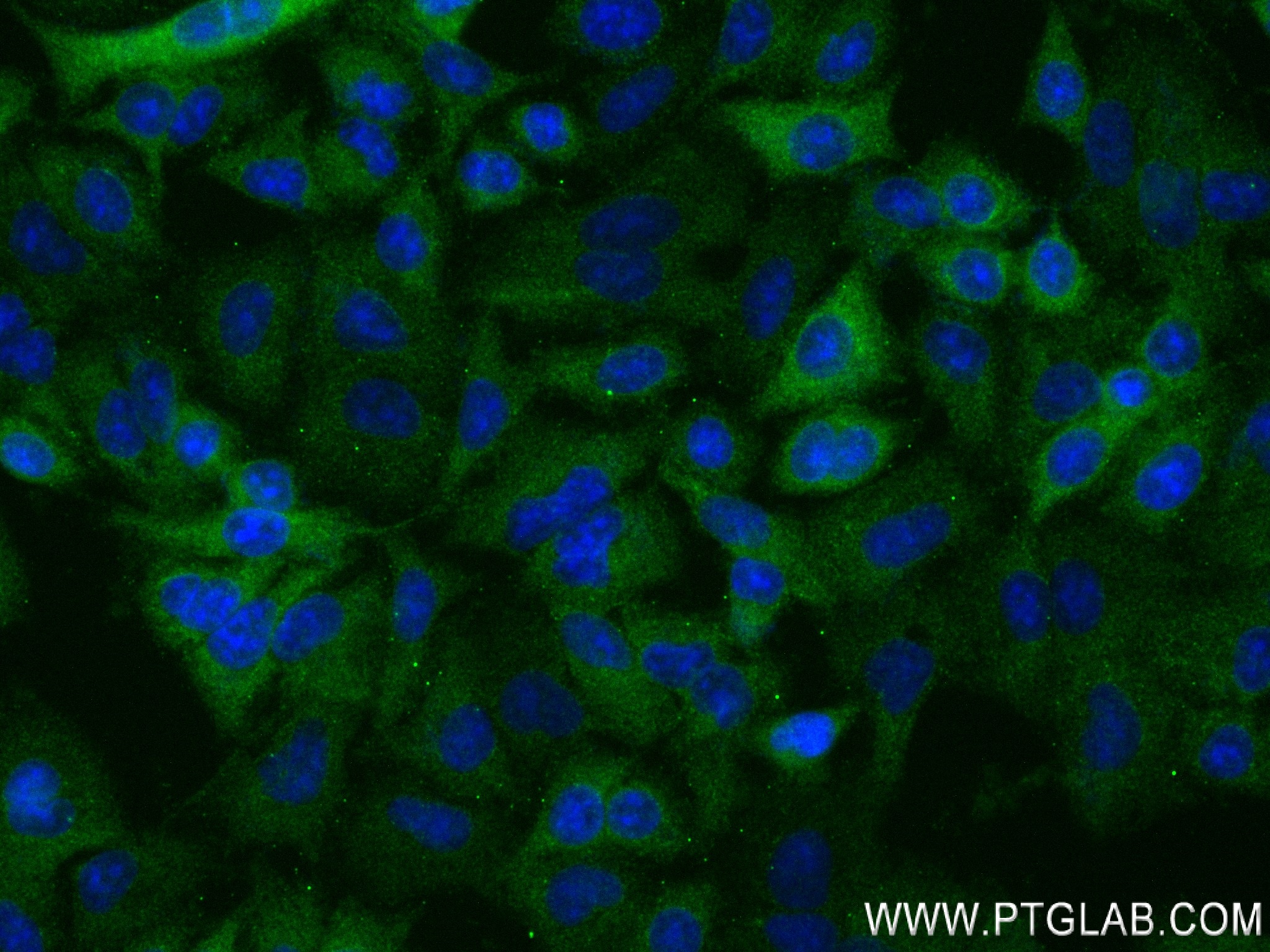 IF Staining of A549 using 84230-5-RR (same clone as 84230-5-PBS)