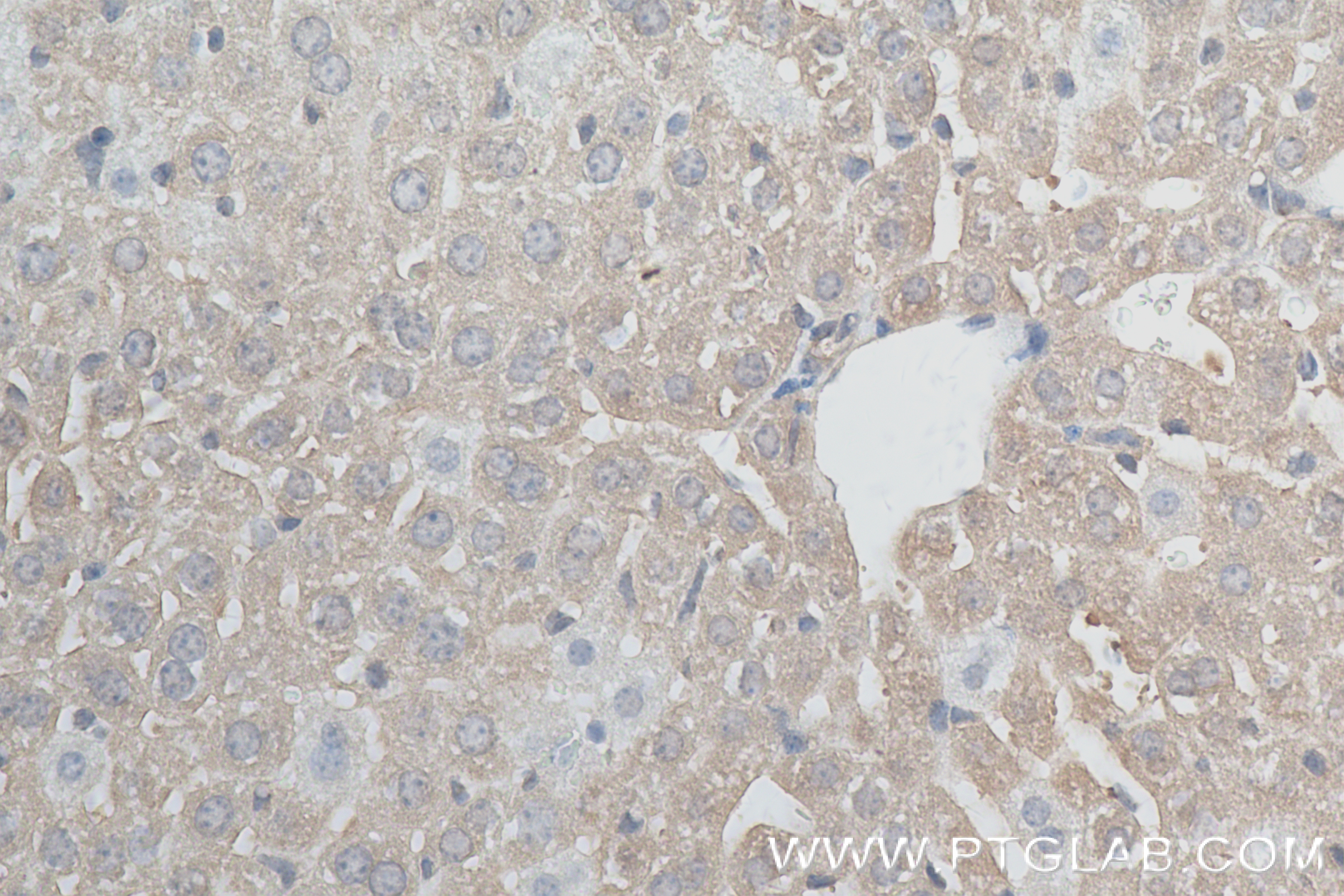 IHC staining of mouse liver using 84230-5-RR (same clone as 84230-5-PBS)